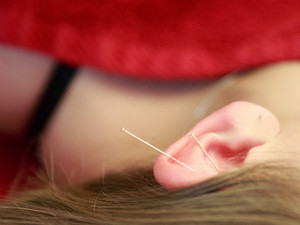Heli Sporthälsa akupunktur